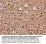 TIPARP Antibody