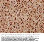 TIPARP Antibody