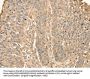 S100A12 Antibody
