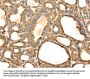 S100A12 Antibody