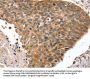 HOXB1 Antibody