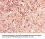 PHLDB2 Antibody