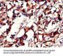 PHLDB2 Antibody