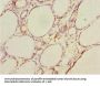 DTX2 Antibody