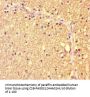 ZBTB46 Antibody