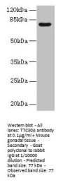 TTC30A Antibody