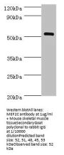 MEF2C Antibody