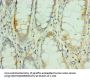 MEF2C Antibody