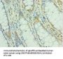 MEF2C Antibody