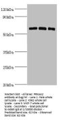 PRKAA2 Antibody