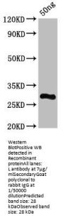 L Antibody