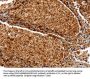 SERPINA3 Antibody
