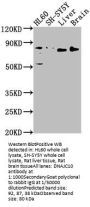 DNAJC10 Antibody