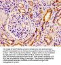 PNPLA6 Antibody
