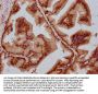 MAML2 Antibody