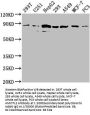 AMOTL2 Antibody