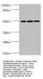 DCP2 Antibody