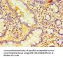 DCP2 Antibody