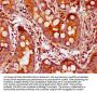 CDAN1 Antibody