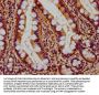RHOT2 Antibody