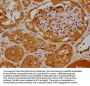 RHOT2 Antibody