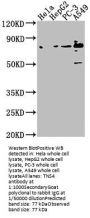 TNS4 Antibody