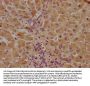 CLEC10A Antibody