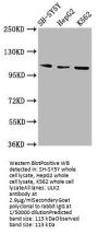 ULK2 Antibody