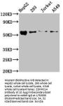ZDHHC14 Antibody