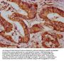 ZDHHC14 Antibody