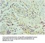 SERPINA12 Antibody