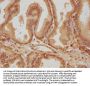 SUPV3L1 Antibody