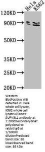 SUPV3L1 Antibody