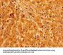 MCAT Antibody