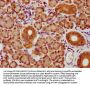 CMIP Antibody