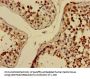 ELMOD2 Antibody