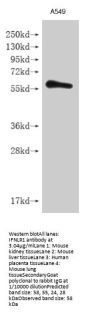 IFNLR1 Antibody