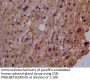 IFNLR1 Antibody