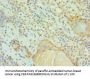 CCAR1 Antibody