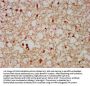 FAM20C Antibody
