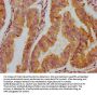 TIAM2 Antibody