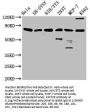 KMT2E Antibody