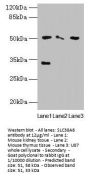 SLC38A6 Antibody