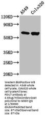 PDILT Antibody