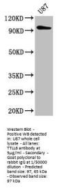 TTLL6 Antibody