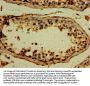TTLL6 Antibody