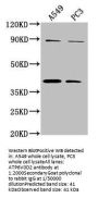 ATP6V0D2 Antibody