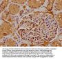 ATP6V0D2 Antibody