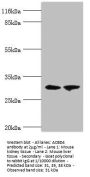 ACBD4 Antibody