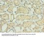 ACBD4 Antibody